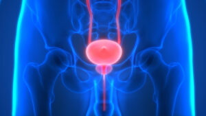 leczenie chorób prostaty